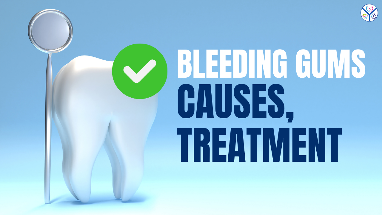 Bleeding Gums causes, treatment